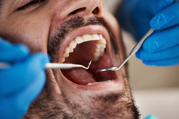 Best Urgent Tooth Repair  in Hamilton, AL