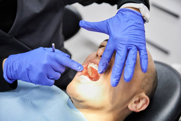 Best Root Canal Emergency Dentist  in Hamilton, AL
